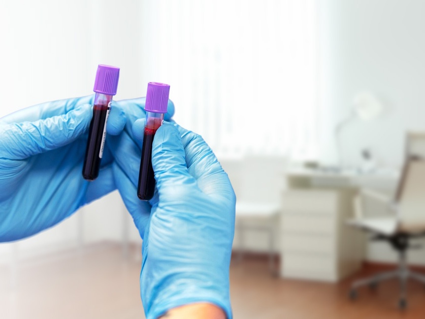 Odběrový box - Nemocnice Rudolfa a Stefanie Benešov