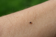 Nemoci z klíšťat prudce rostou, odborníci varují před druhou vlnou